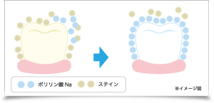 ポリリンプラチナホワイトニング